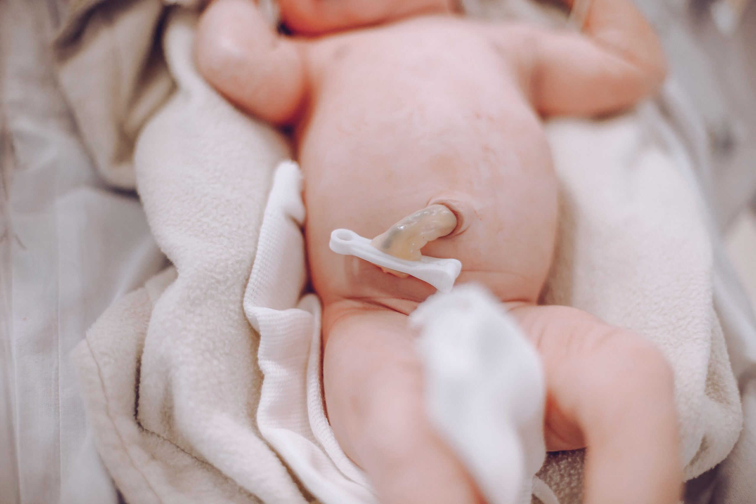 Caring For Your Baby's Umbilical Cord Stump: Tips and Recognising Infection  Signs - Carla Corral Lactation Consultant